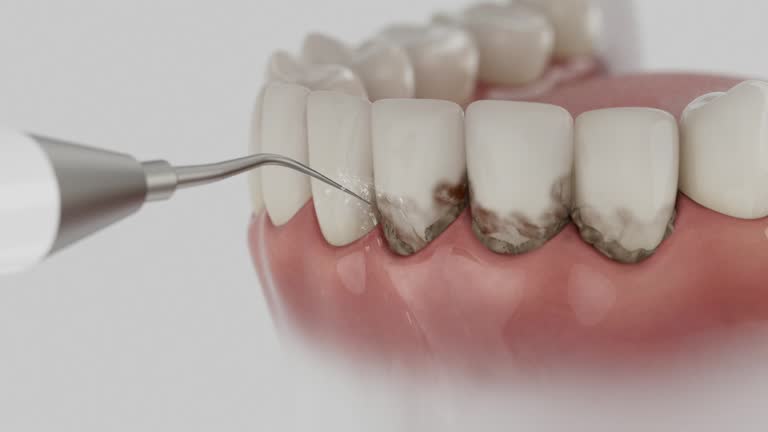 Trusted Tooth Extraction service in Memphis, MI - Dentist Open Now